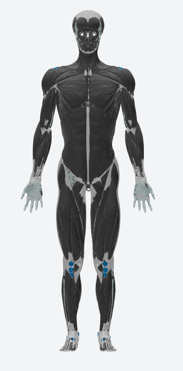 tibia-example